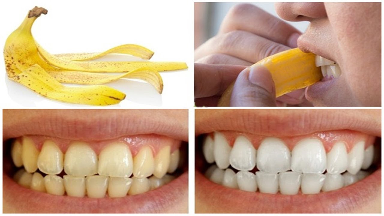 можно ли банан после отбеливания зубов